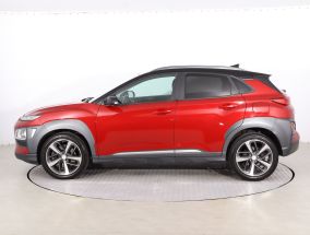 Hyundai Kona - 2018