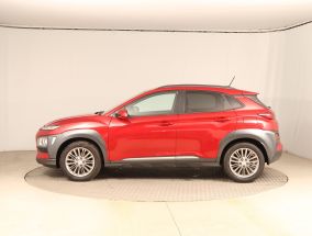Hyundai Kona - 2018